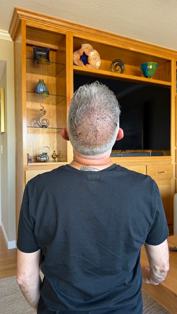 ReGrow Hair Restoration - Transplant & Restoration Clinic - Las Vegas, photo 2