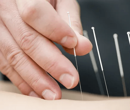 "Magic Needle" Acupuncture and Herbal Clinic, photo 3