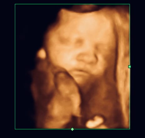 Sneak A Peek Ultrasounds, photo 4