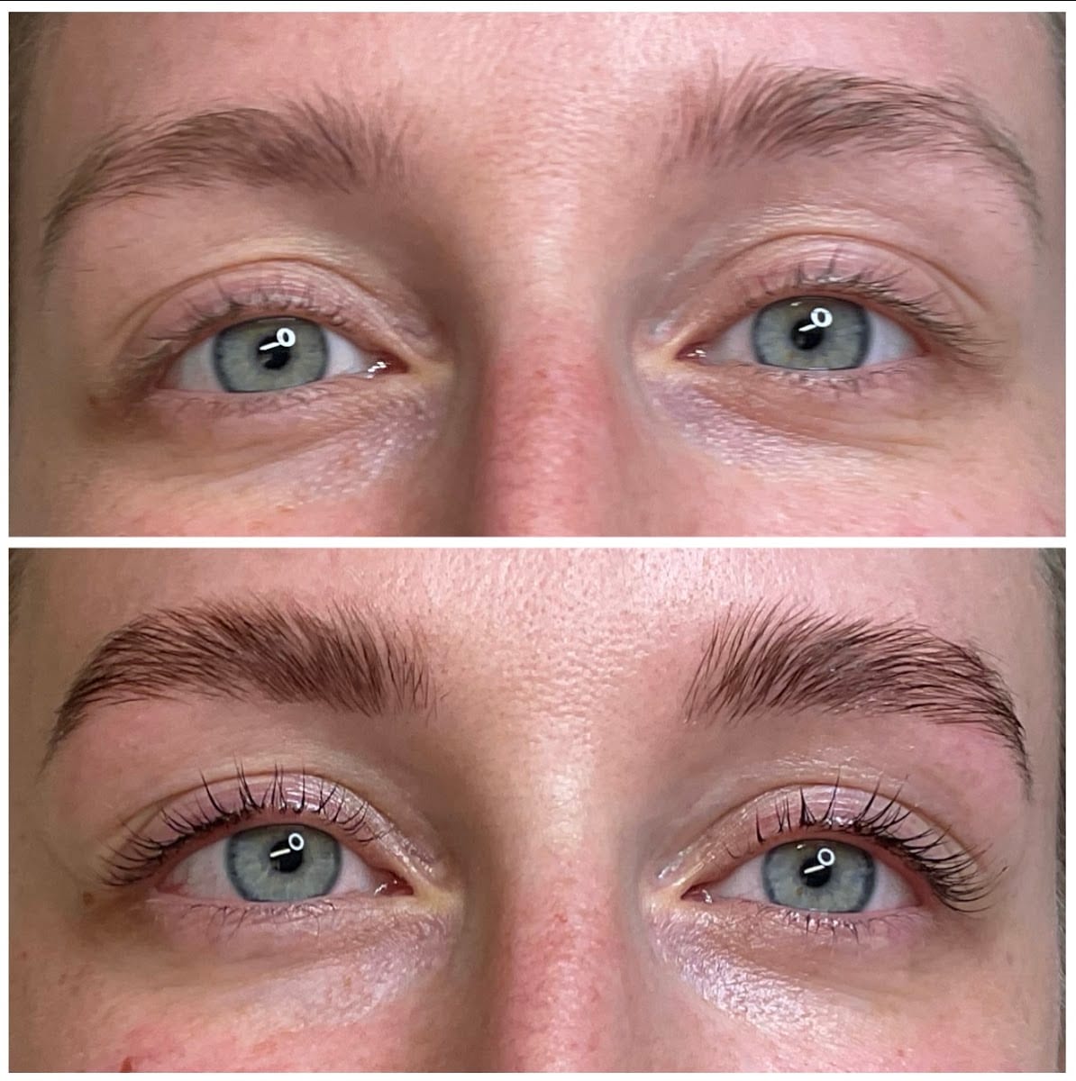 National Hair Loss Medical Aesthetics