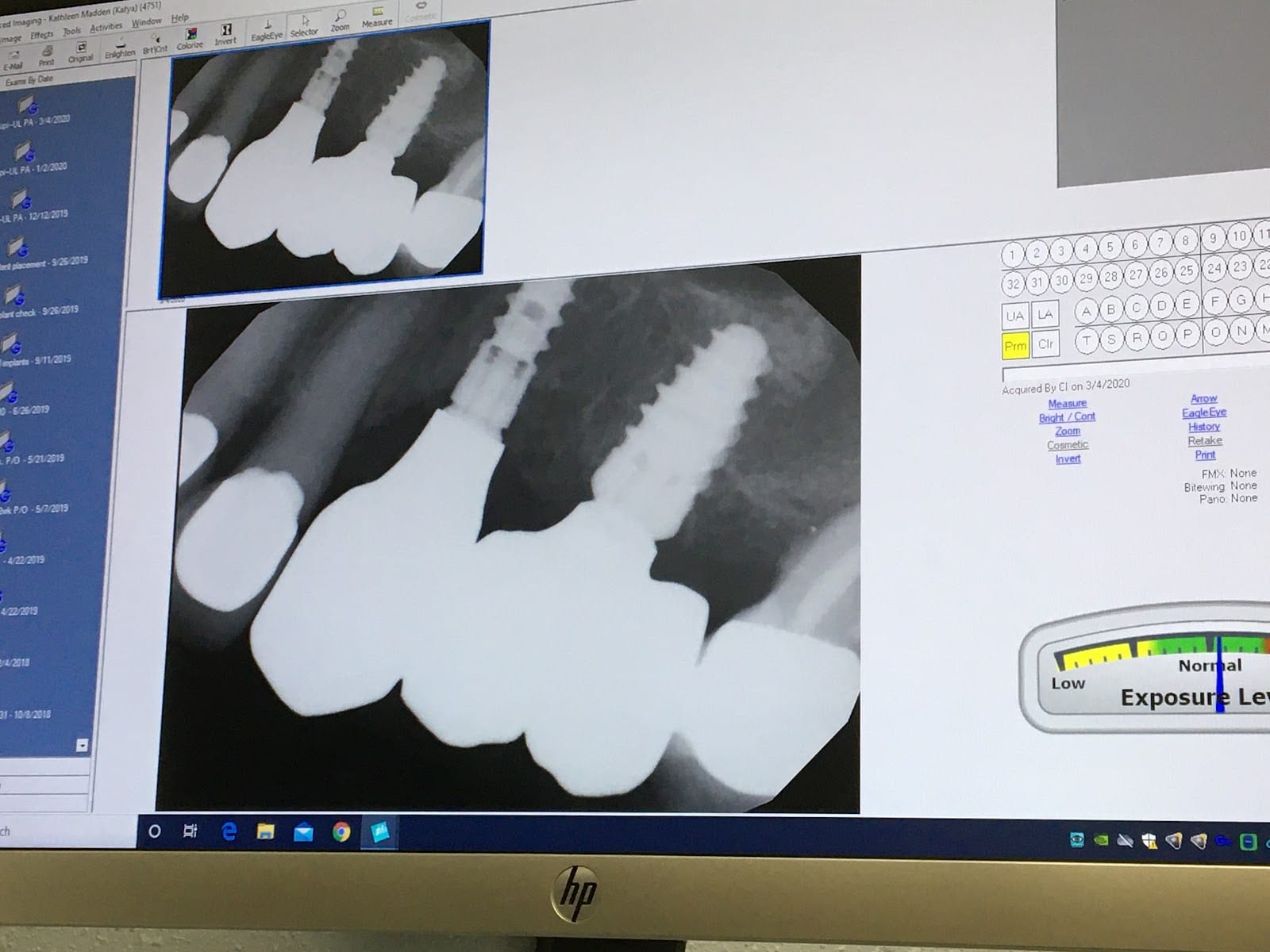 Dr. Brian Crupi - Venice Island Dental