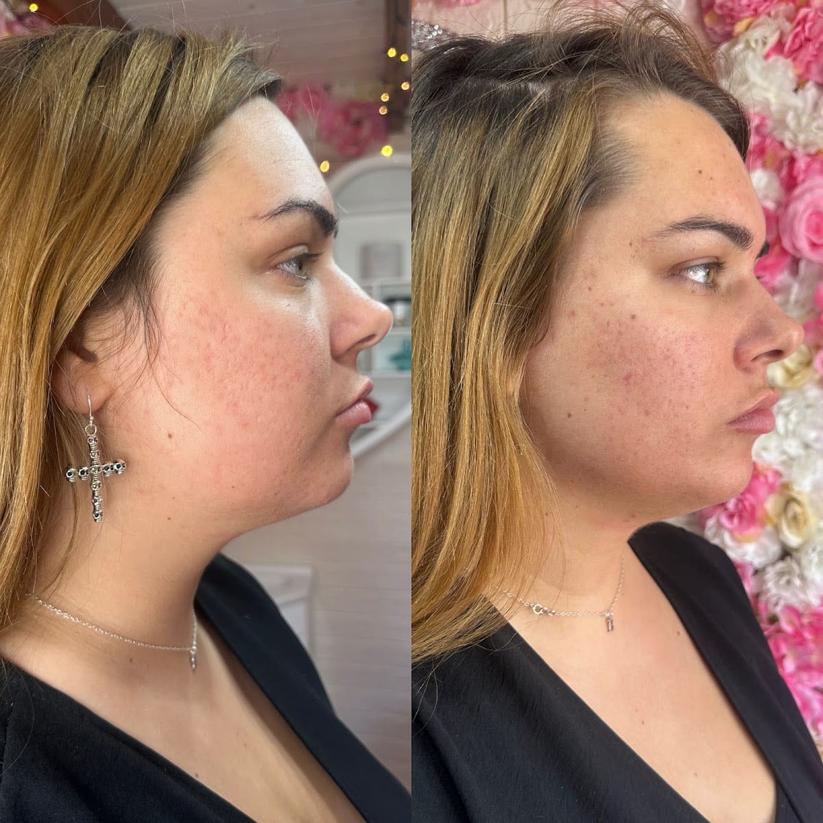Elladoons Aesthetics, Beauty & Clinical Hypnotherapy Clinic