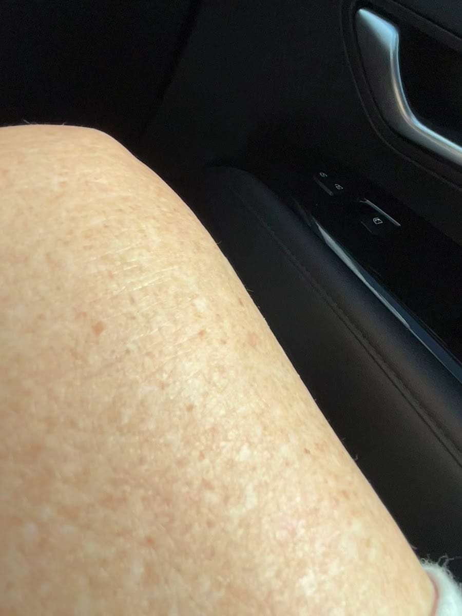 Riverchase Dermatology - Tampa Palms, photo 3