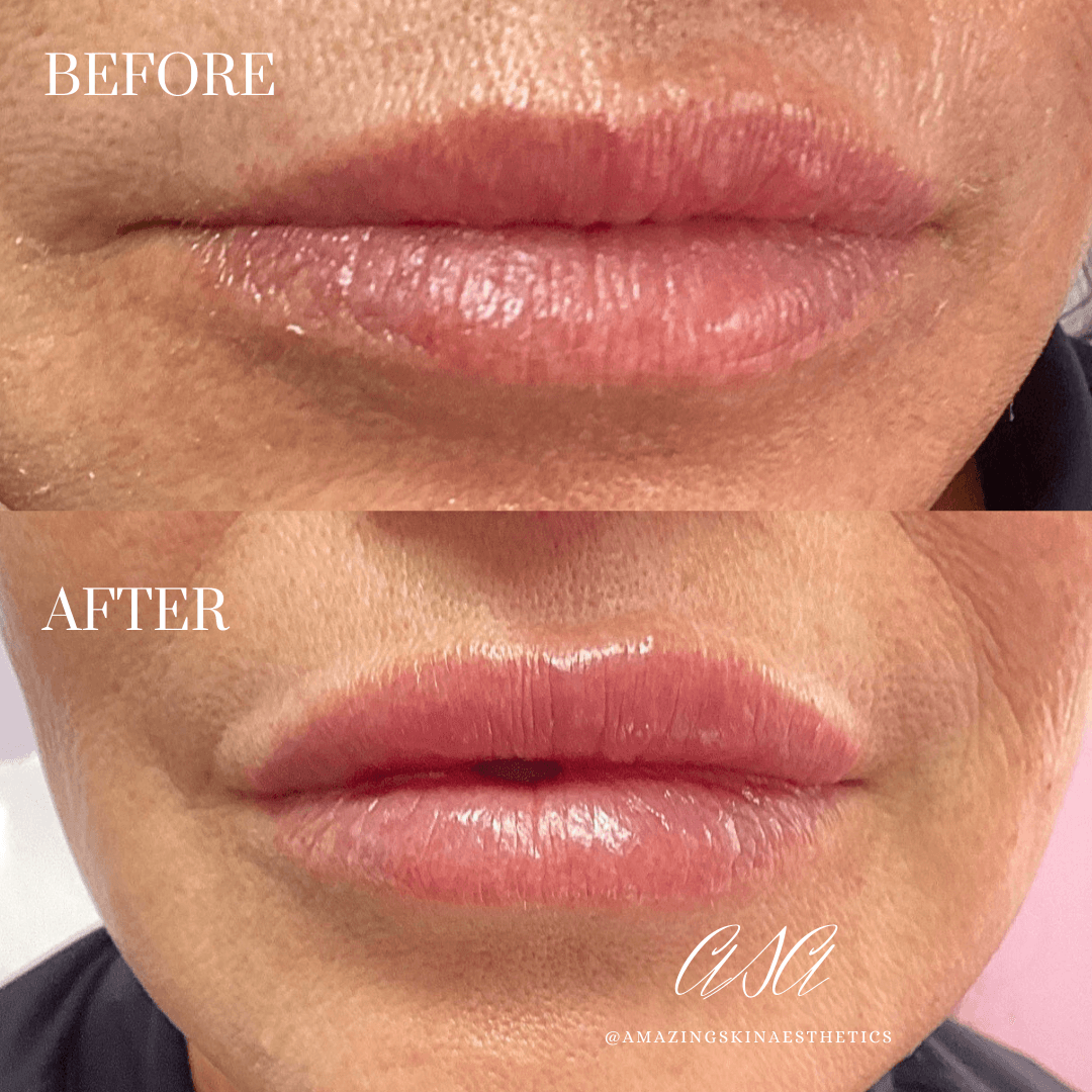 Amazing Skin Aesthetics