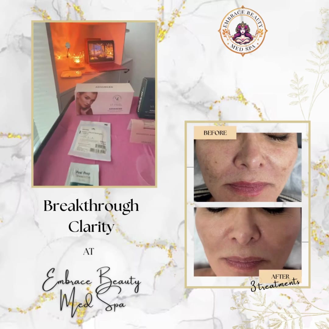 Embrace Beauty Med Spa, photo 3