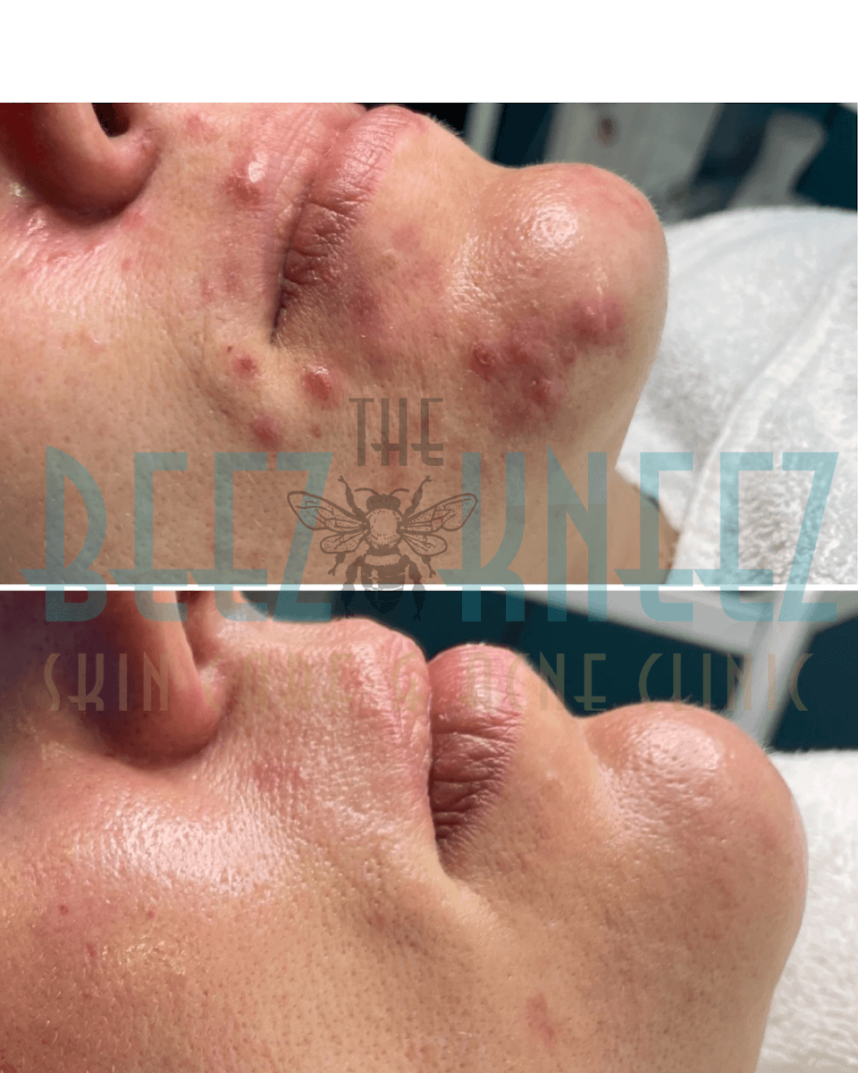 The Beez Kneez Skin Care & Acne Clinic, photo 2