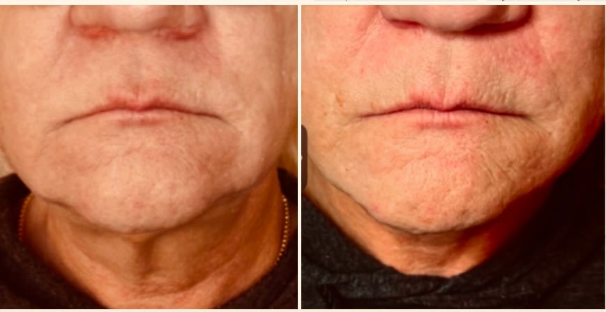 Face to Face Medical Spa