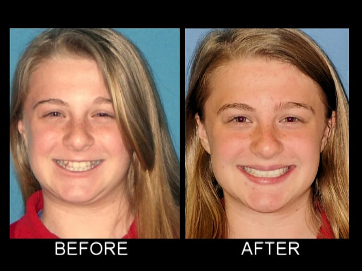 Parrish Orthodontics | Orthodontist Fort Wayne, photo 2