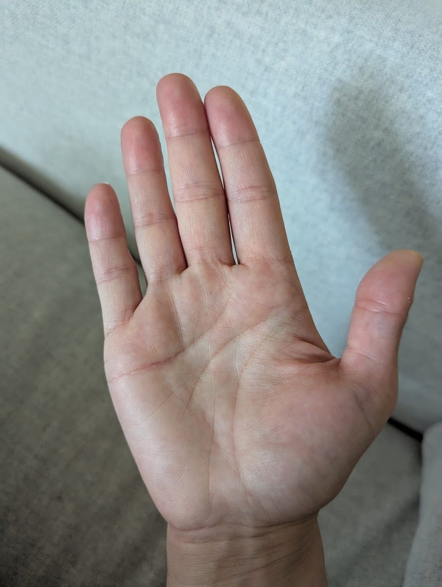 Six Physio, photo 4
