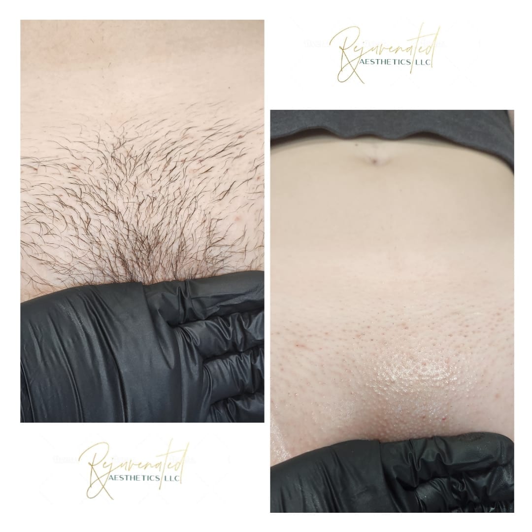 Rejuvenated Aesthetics LLC