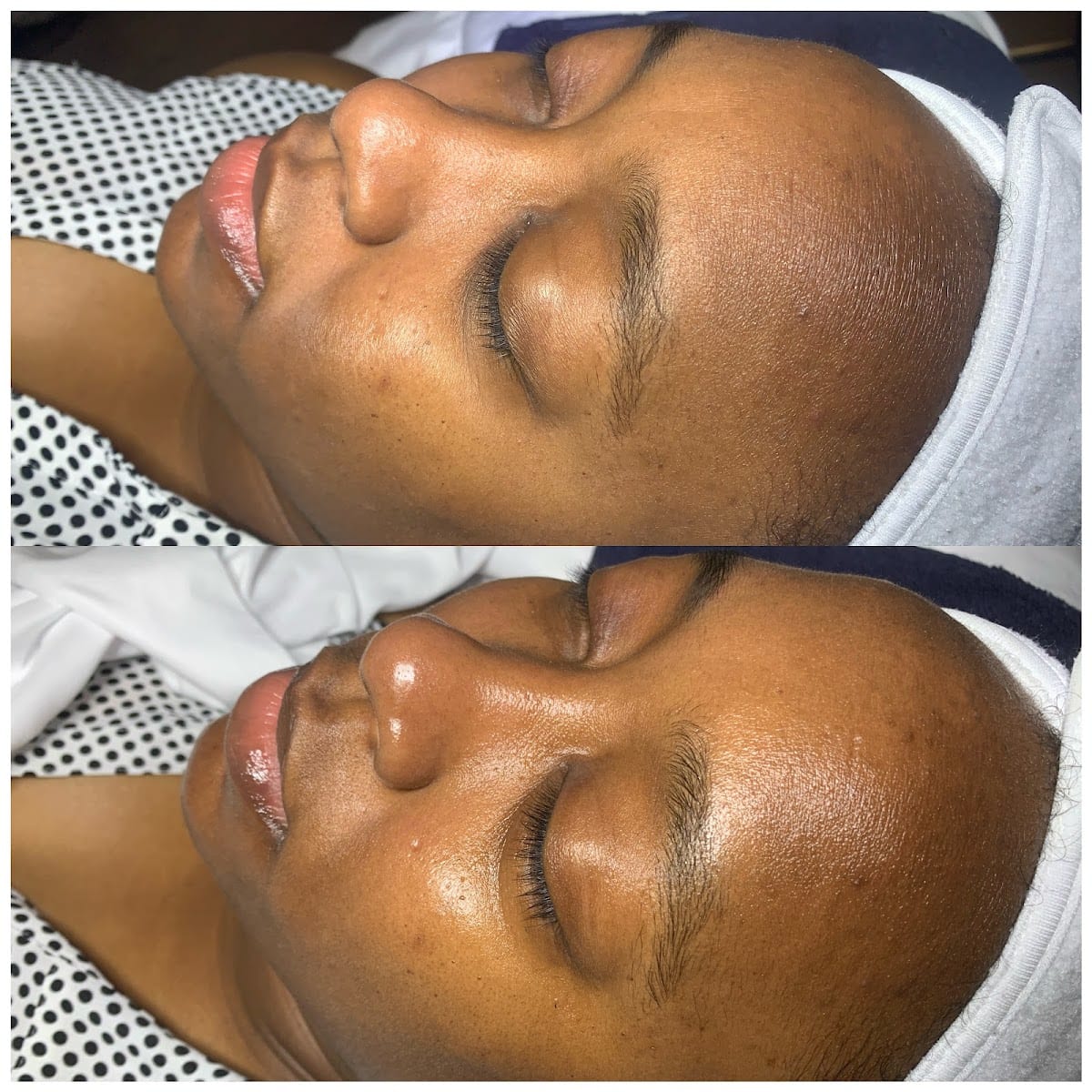 Skin Escape, photo 4