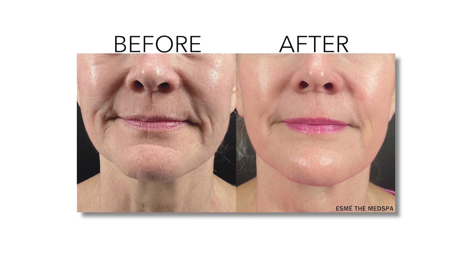 Nuview Aesthetics & Wellness, photo 3