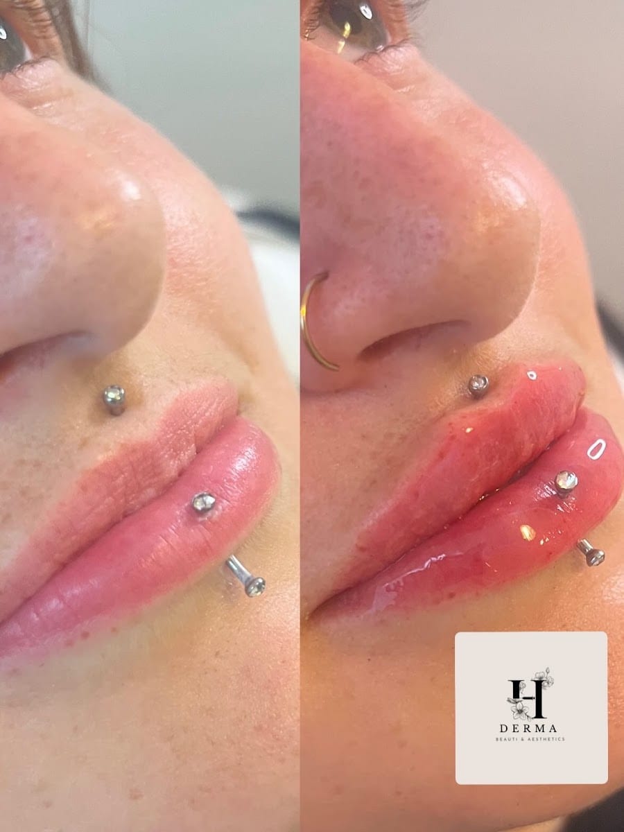 H Derma Beauti & Aesthetics