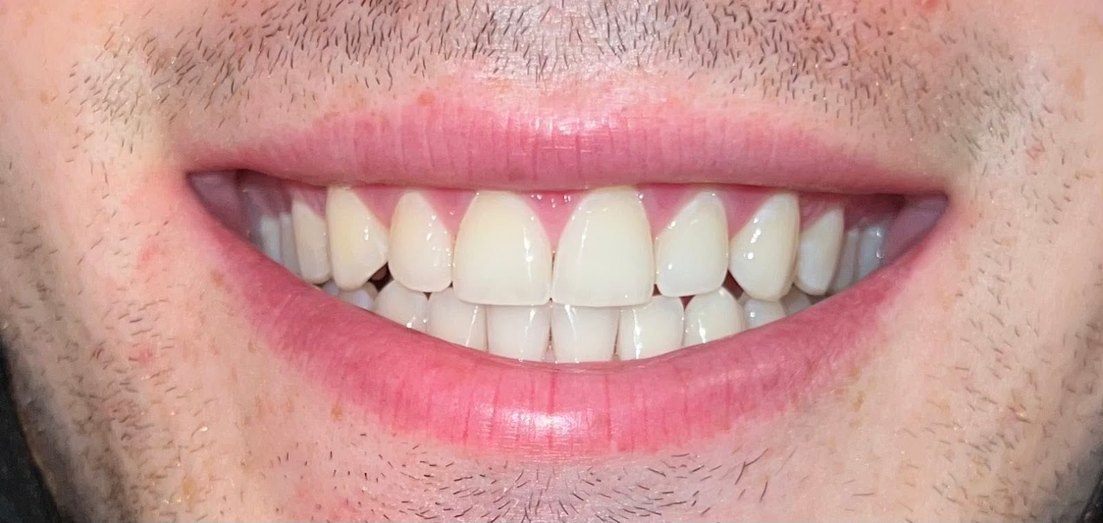 California Dental Innovations: Mina Levi DDS, photo 4