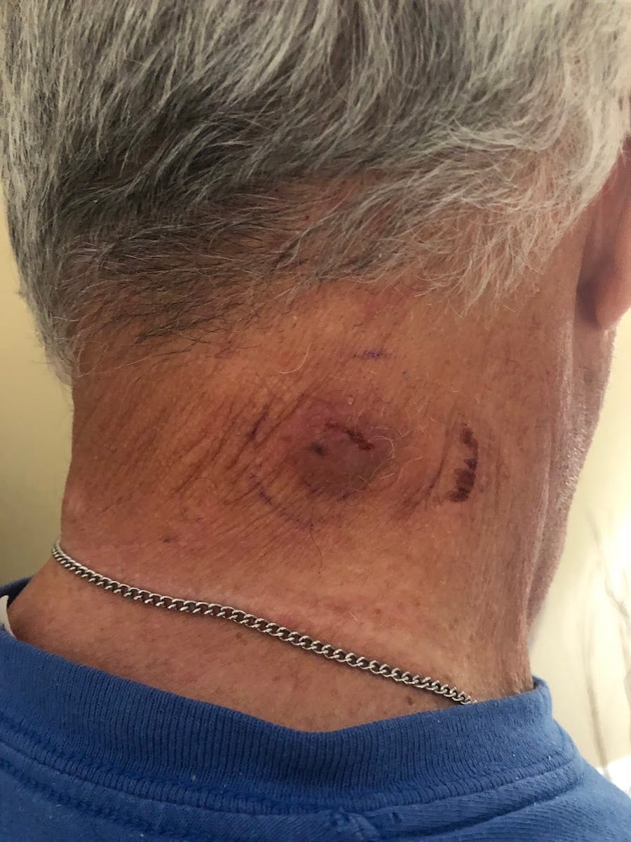 Jeffrey R. Hunek, M.D., Venice Avenue Dermatology, photo 3