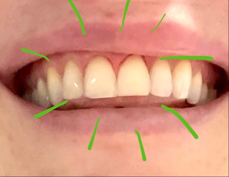 BaeMax Dental, photo 4