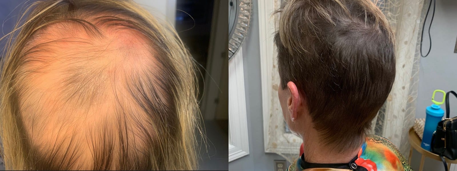 Arizona Aesthetics | Hair Restoration & Stem Cell Therapy, photo 2