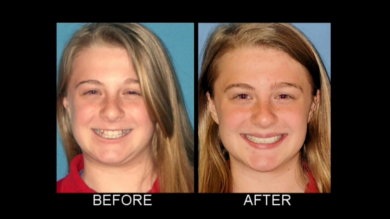 Parrish Orthodontics Jefferson Blvd | Fort Wayne, photo 3