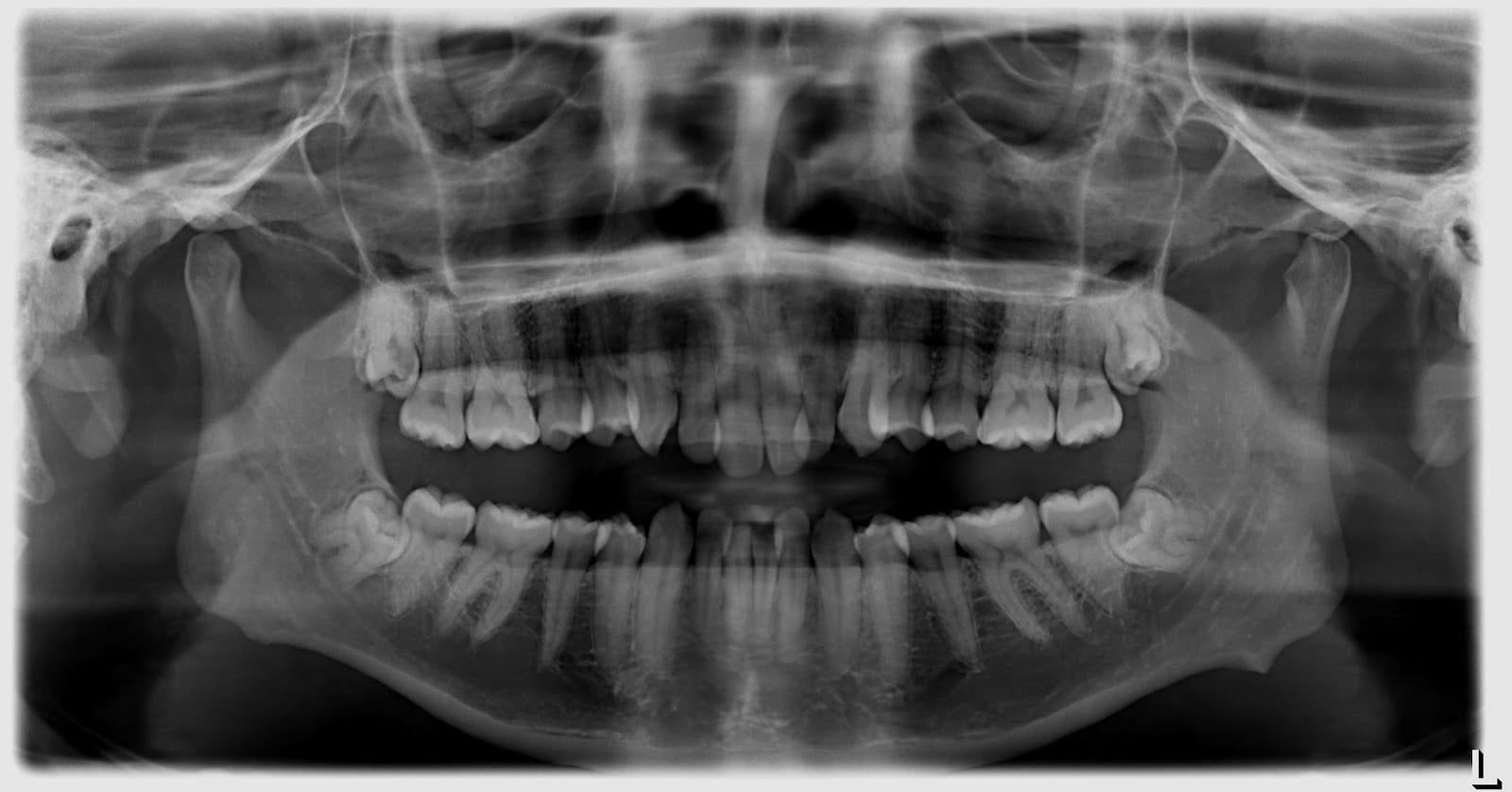 Bayview Hill Centre Dental 富豪中心牙科（ Dental Clinic in Toronto, Ontario 多伦多牙医：种牙、拔牙、洗牙、假牙、矫牙等服务）