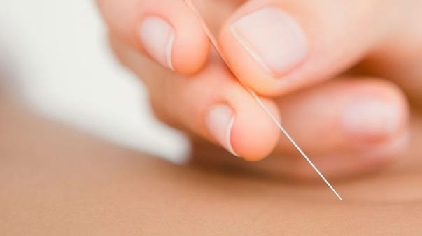 Annapolis Doctors of Acupuncture