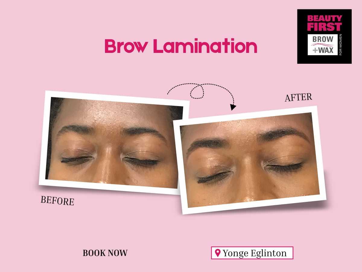Beauty First Spa - Yonge Eglinton