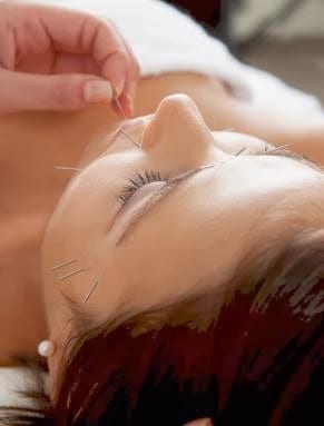 Sheri Barnes Acupuncturist
