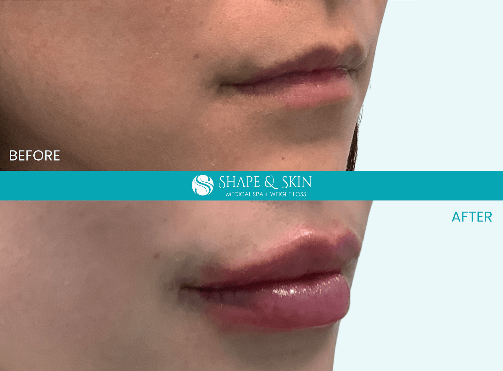 SHAPE & SKIN Medical Spa & Weight Loss, photo 3