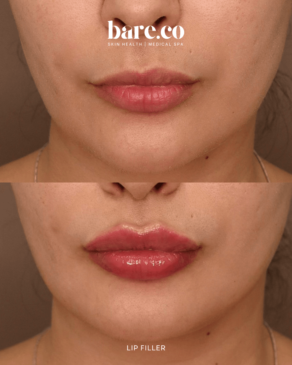 Bare.co Skin Health and Medical Spa