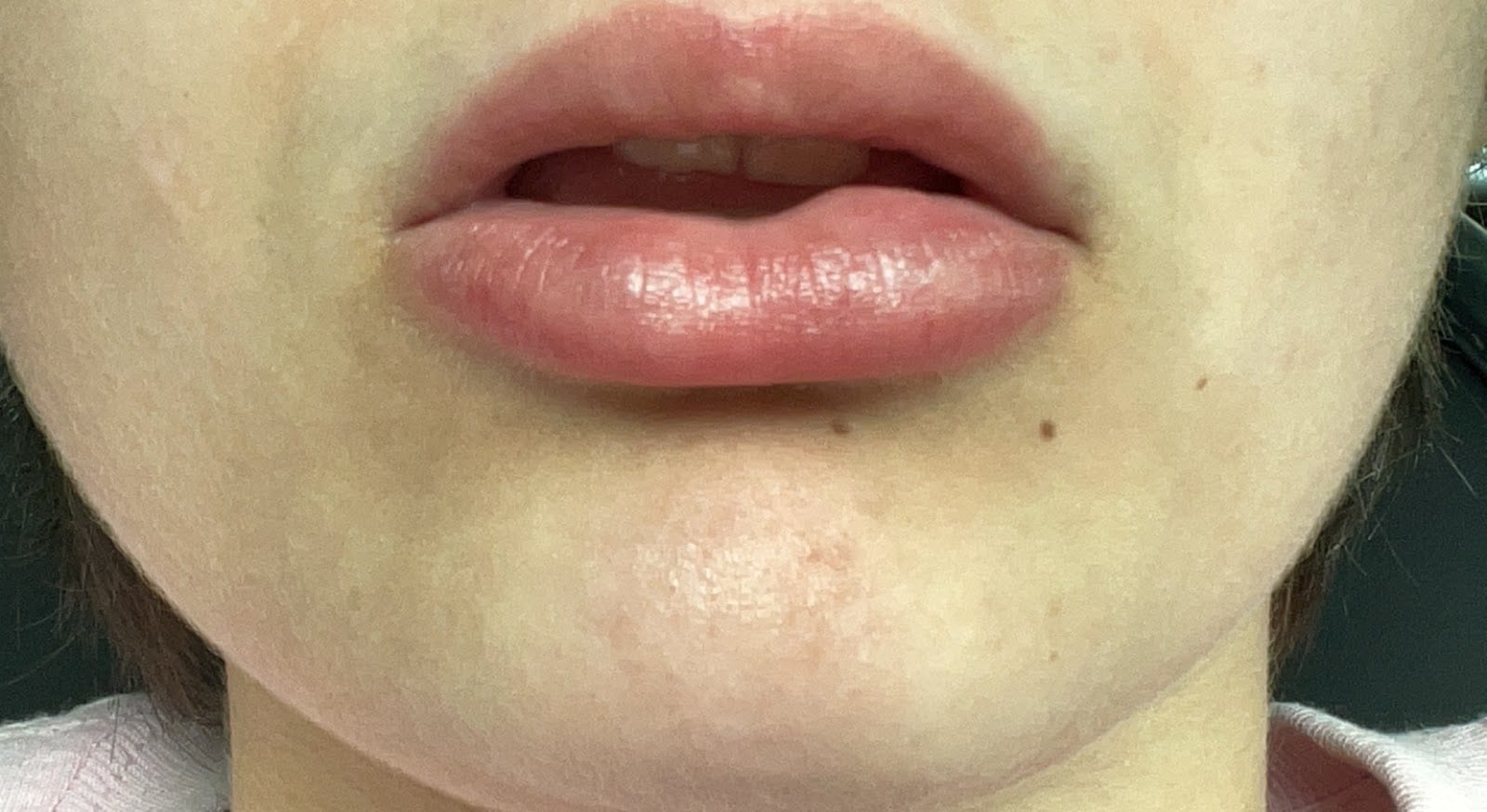 Medical Cosmetic Center / Ivers MD, photo 4