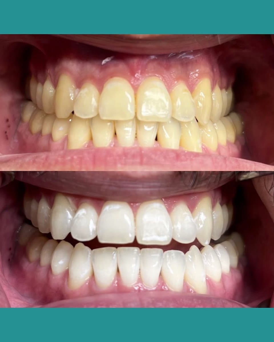 6006 Yonge Dental, photo 4