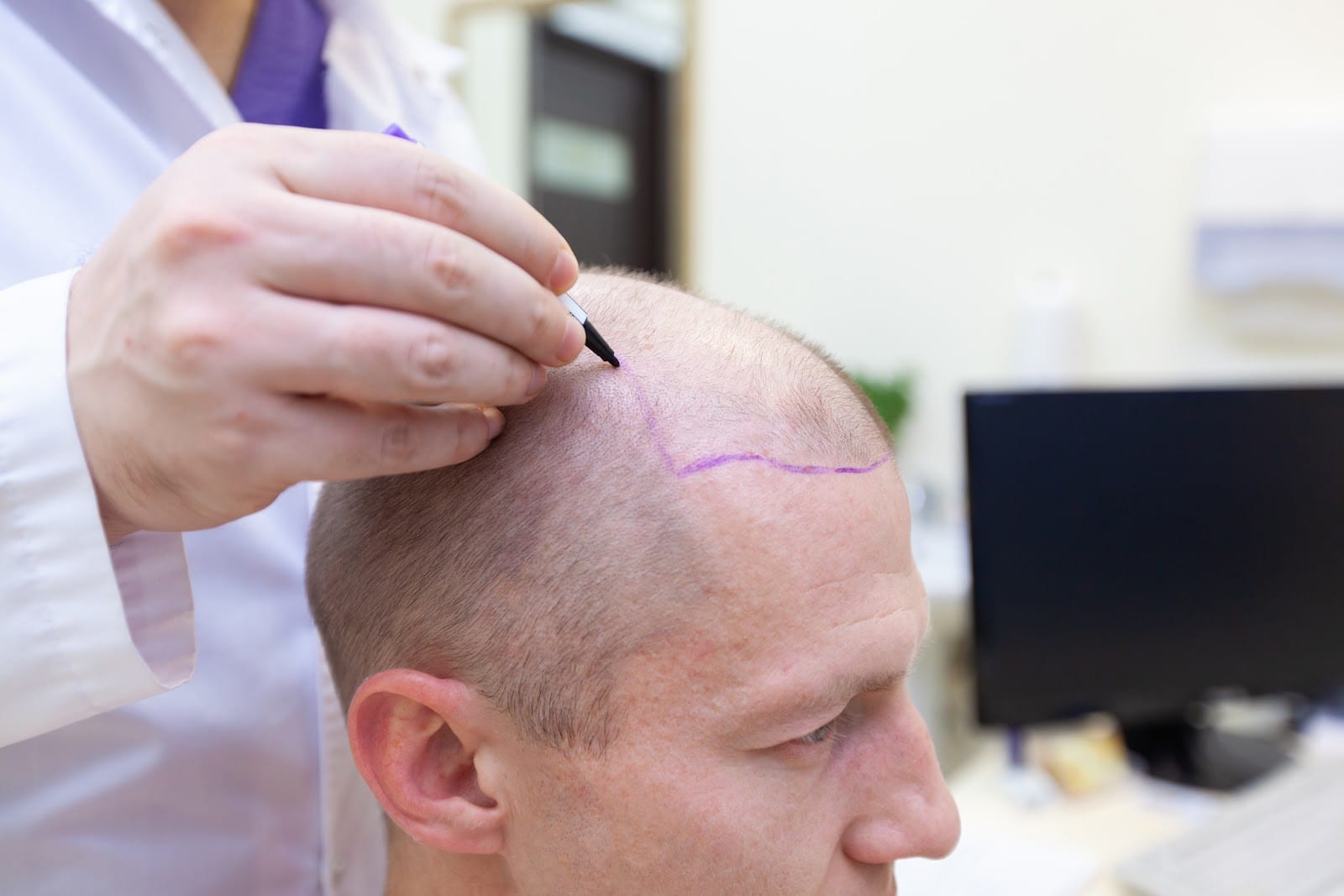 The Stem Cell Hair Restoration Clinic | Cendant, photo 4