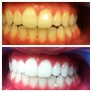 The Emergency Dental Repair, photo 4