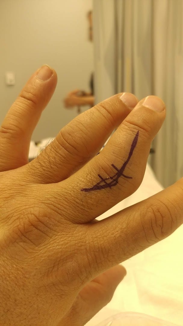 Florida Hand Center: Dr. Stephen Helgemo, photo 4