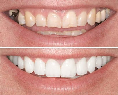 Inspire Dental of Summerlin- Dr. Matthew J. Wilson