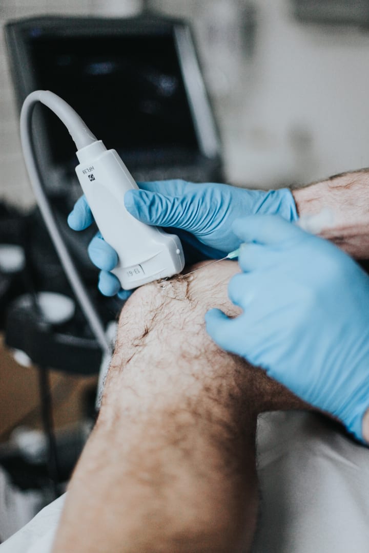 Ultrasound Guided Injections City of London, photo 2