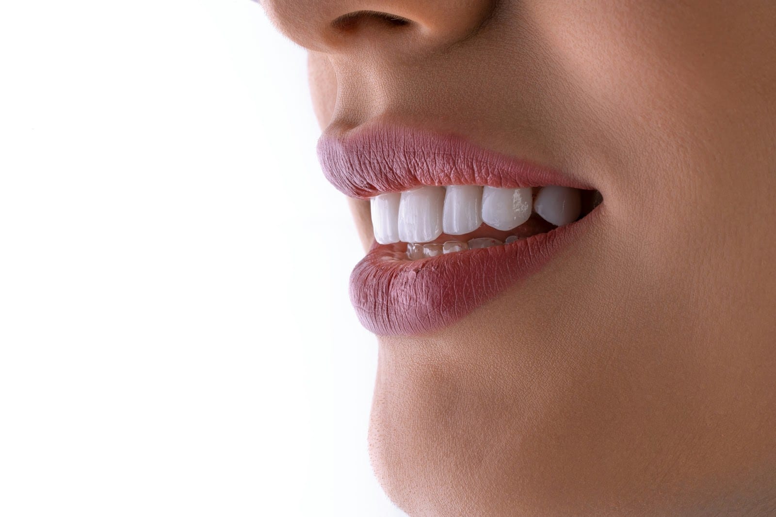 ProGrin Dental of Powdersville, photo 3