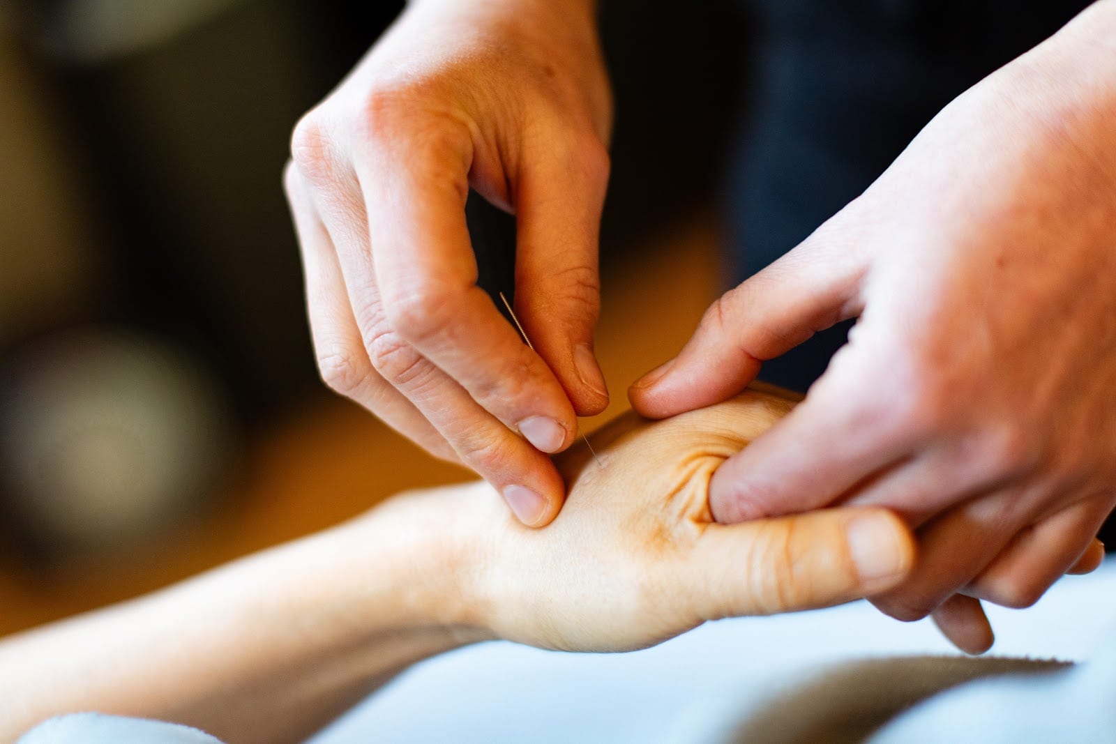 Bridge Acupuncture, photo 4