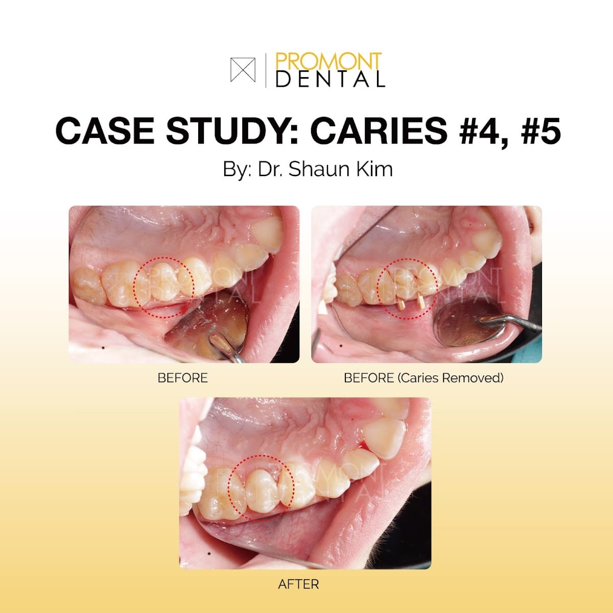 Promont Dental Design, photo 4