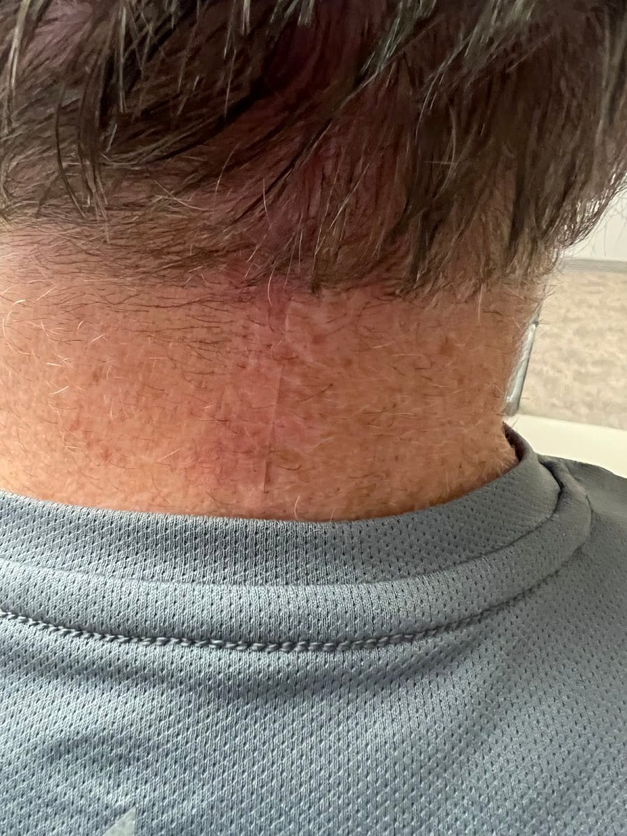 Dr. Christopher Wolfe, DO, FACMS- Dermatology Associates Skin & Cancer Center Mohs Micrographic & Reconstructive Surgeon, photo 3