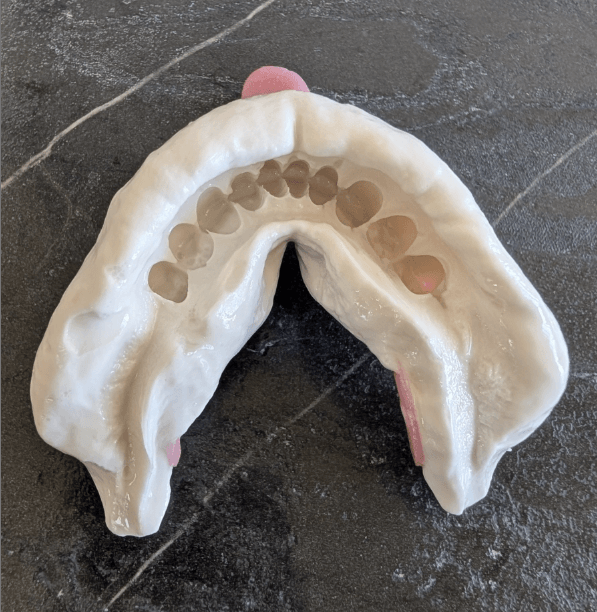 Cane to Coast Dentures Mackay, photo 4