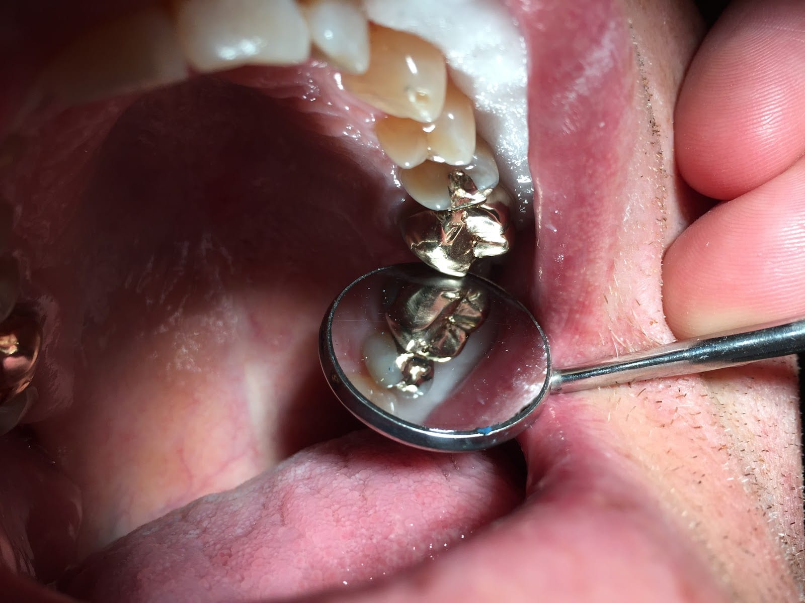 Cache Valley Dental Associates Biological Dentistry