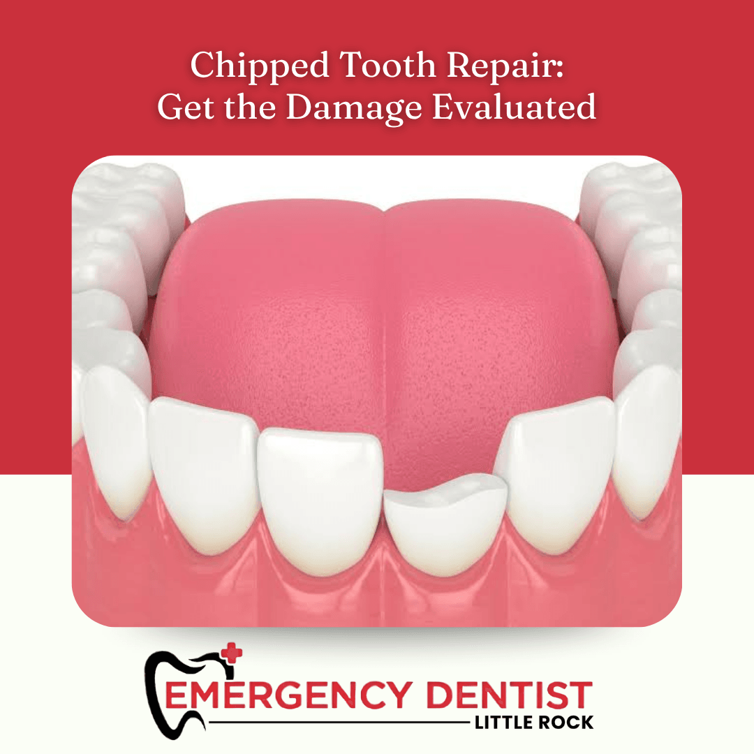 Emergency Dentist Little Rock, photo 2