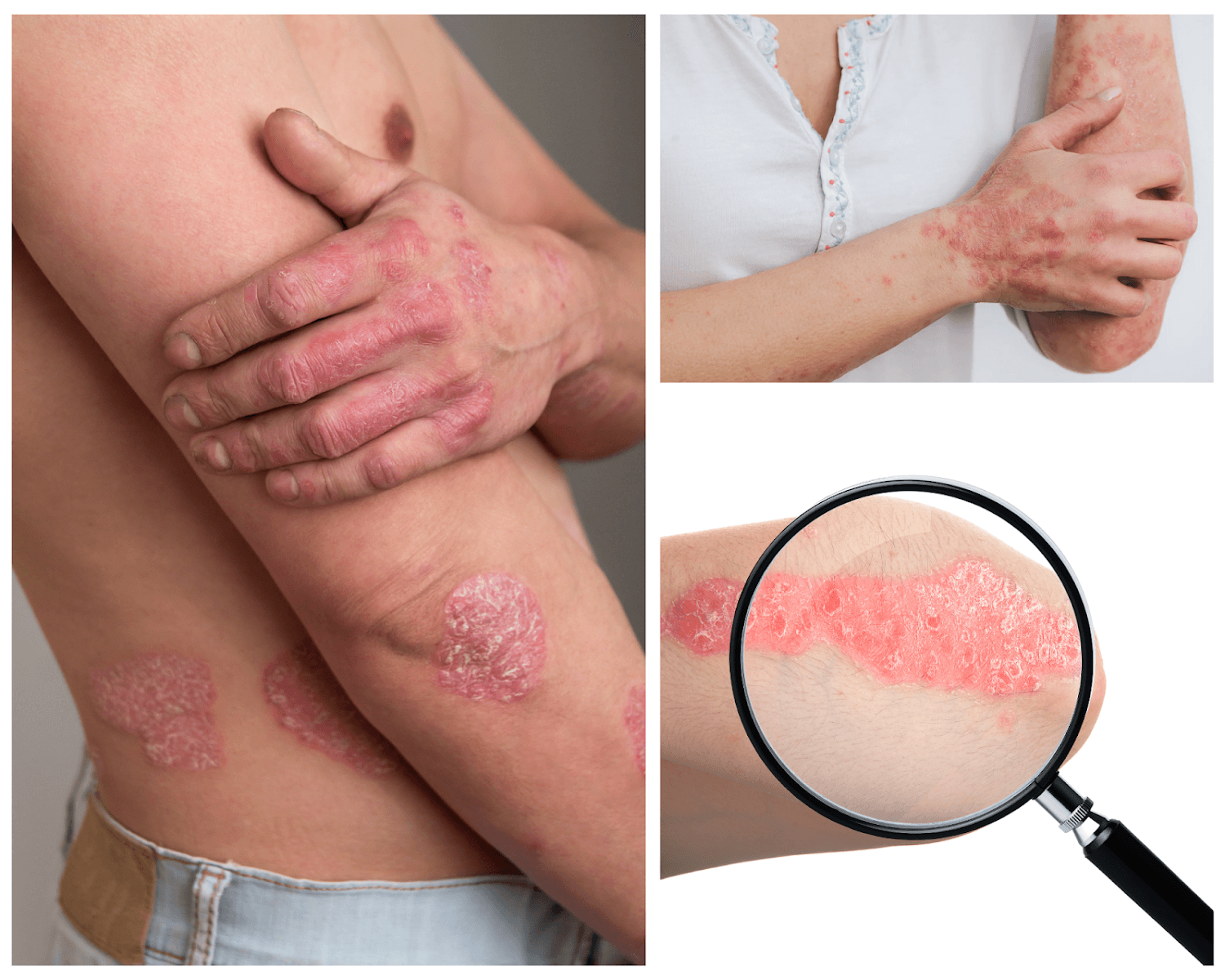 Dermatology Clinic AZ