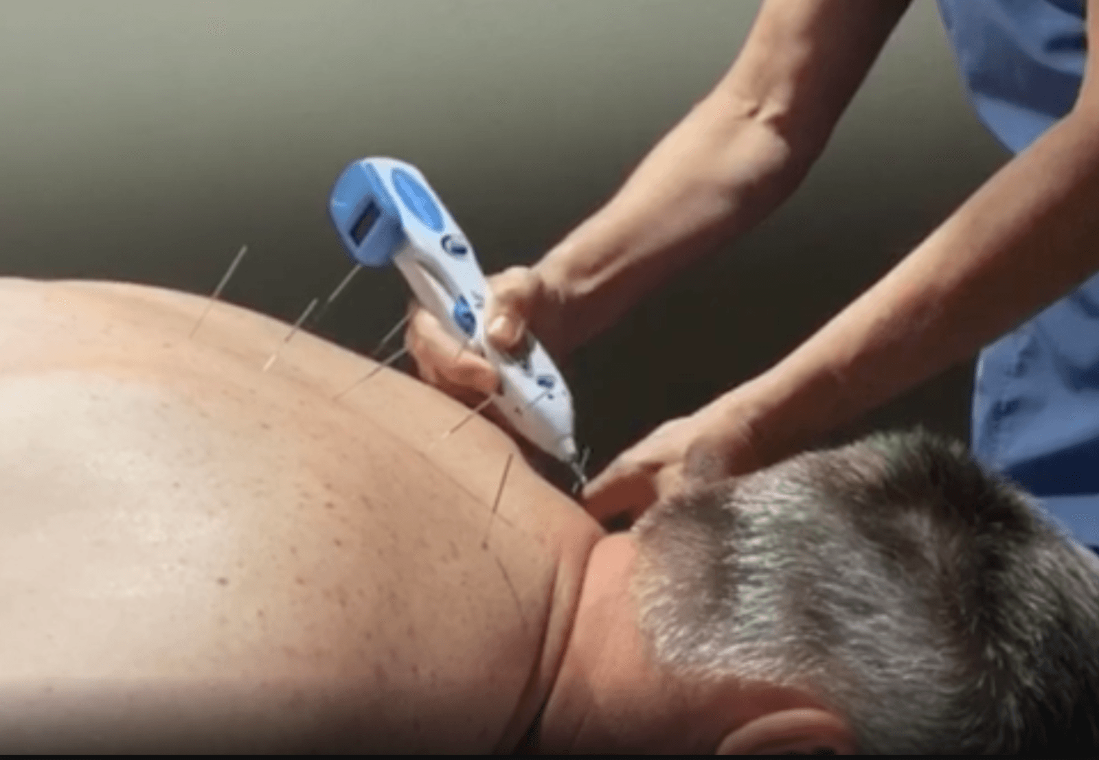 Deep Relief Acupuncture and Chiropractic, photo 4