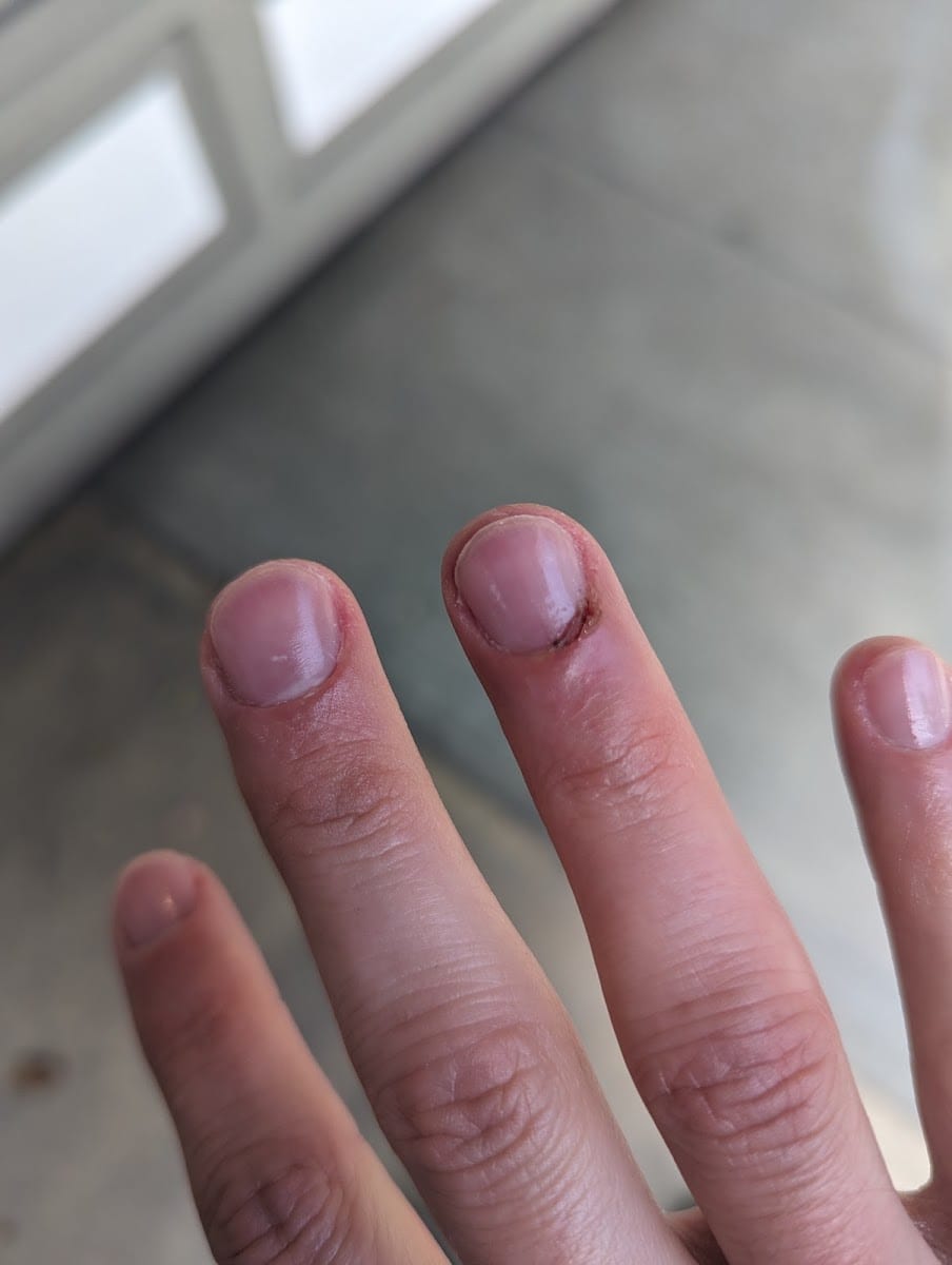 Healthy Nails, photo 2
