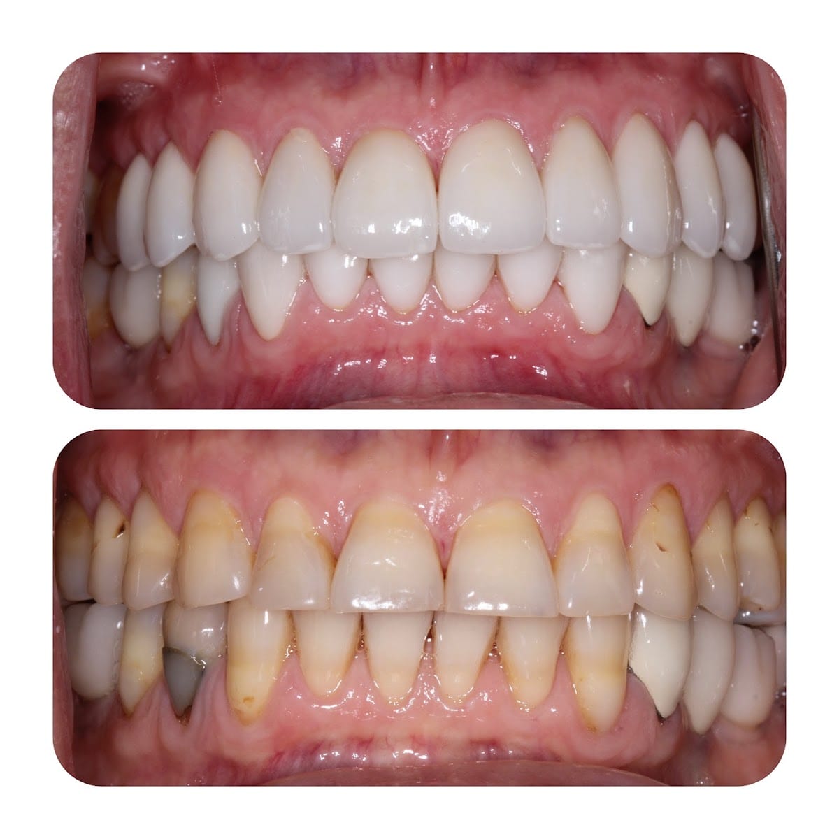 Newtonbrook Dental