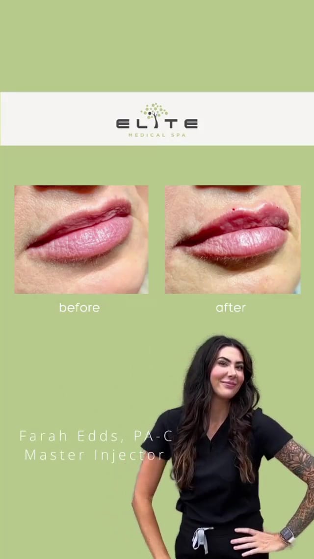 Elite Medical Spa of Sarasota, photo 3