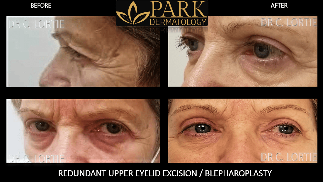 Park Dermatology