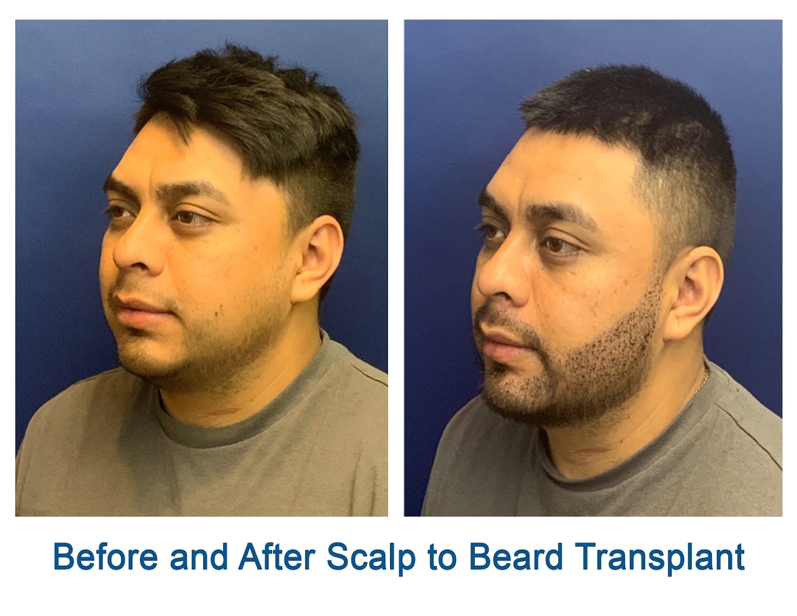 Baldev Sandhu MD, Plastic Surgeon, photo 3