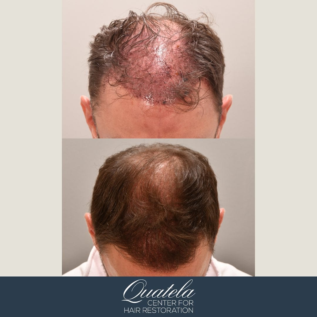 Quatela Center for Hair Restoration, photo 4